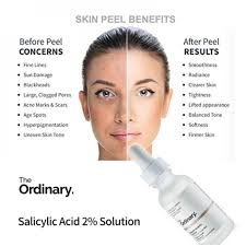 The Ordinary Niacinamide 10% + Zinc 1% Serum